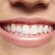 Best teeth whitening Services in calgary