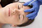 Lip Injections Calgary