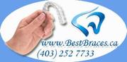 Invisalign Braces
